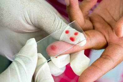 Pain diagnosis in finger joints