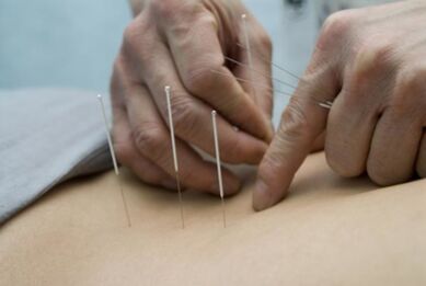 Acupuncture for osteochondrosis of the thoracic region